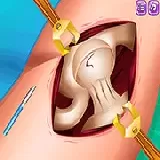 Princess Heupen Chirurgie